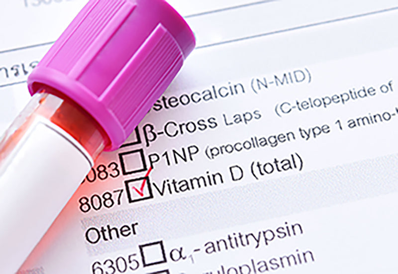 Deficiency or no deficiency? Determine vitamin levels with home nutrient tests